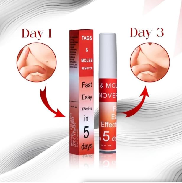 Tags & Moles Remover
